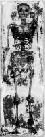 Skeleton IV #WG112371 Skeleton IV #WG112371